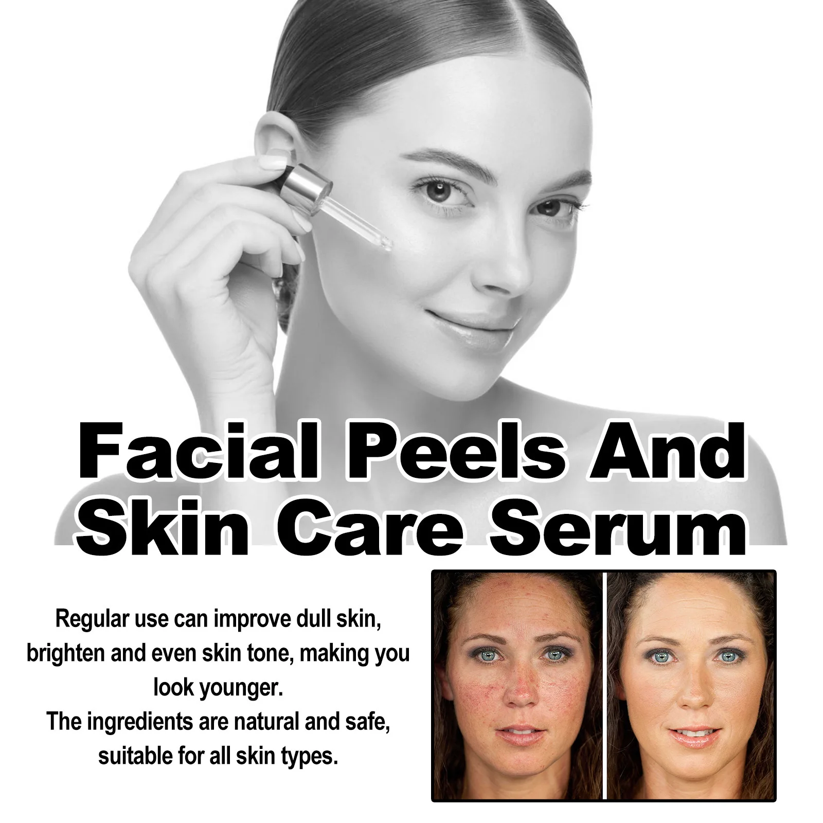 

Fade and Dark Spots Anti-aging Essence Chemical Exfoliants Moisturizer Face Oils Salicylic Acid Face Peel Neutraliser