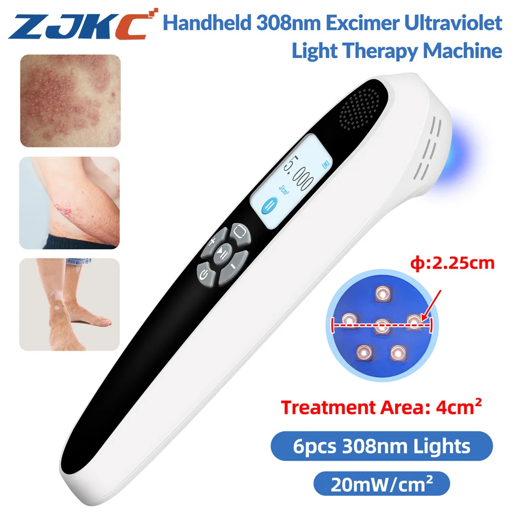 Máquina de Terapia de Luz UVB Portátil de 308nm para Vitiligo, Psoriasis y Eczema, Lámpara Excimer Portátil para Tratamiento de Área Pequeña en Rostro, Manos y Pies, Uso Doméstico