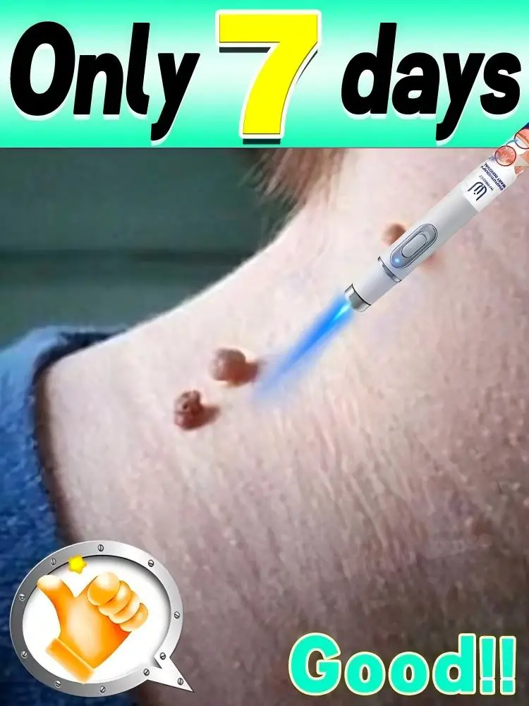 LsWs RWave Off Those Etiquetas de piel sin invitar Removedor de verrugas con luz azul