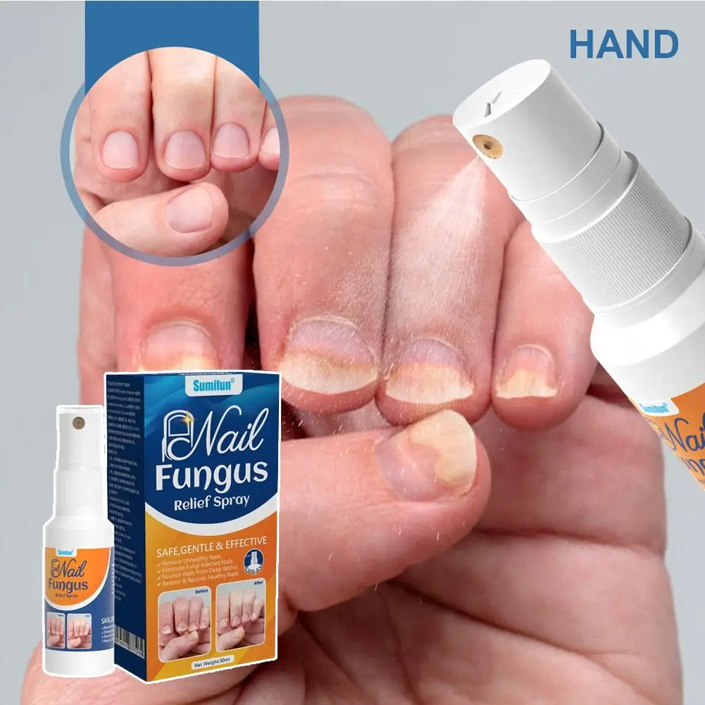 Nail Fungus Relief Spray 30ml Professional Toe Nail Repair Serum For Damaged Unhealthy Nails Recovery Health Care Liquid 1/5PCS