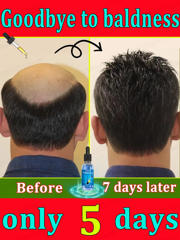 Hair growth essential oil used by celebrities, say goodbye to baldness and hair loss in 7 days, healthy hair is growing