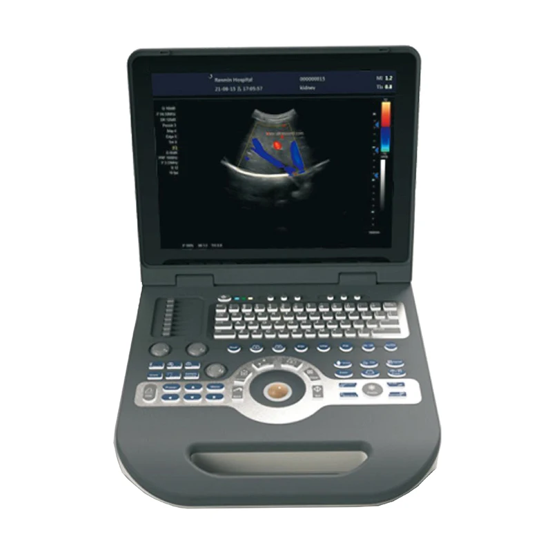 MN-S3500 Color Doppler Ultrasound Diagnostic Instrument  B Ultrasound Machine With 15 Inch HD LED Displayer