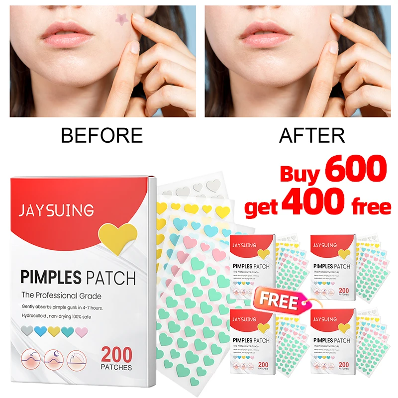 

1000 Patches Acne Pimple Patch Facial Acne Treatment Pimple Spots Remover Professional Healing Absorbing Sticker Face Skin Care