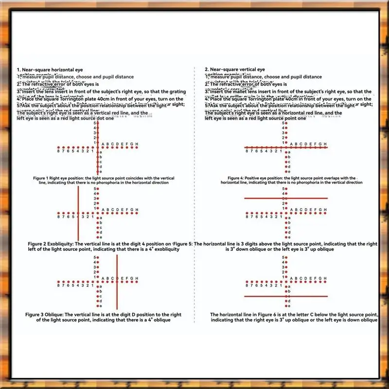 A78K Neues Torrington Block AC/A Ophthalmic Strabismus Detection Tool Fornear-Eye Position Screening