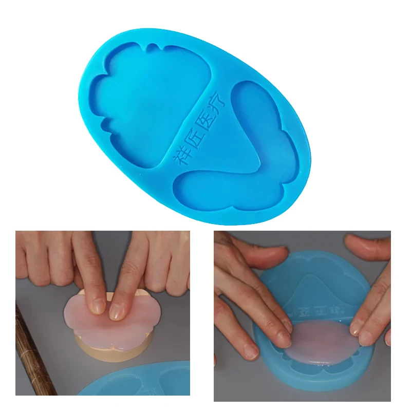 1Pc Full Denture Individual Tray Mold for Self-setting Resin Dental Light-curing Model Temporary Silicone Base Wax Embankment