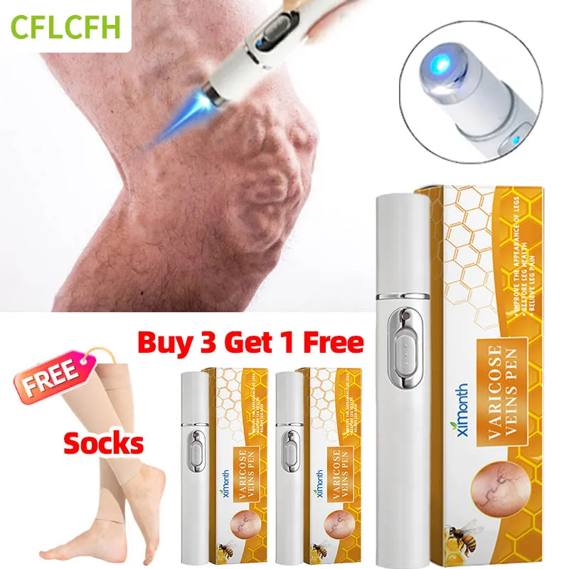 3Pcs Varicose Veins Laser Therapy Pen Relieve Legs Pain Varicose Vein Socks Leg Care For Men And Women Improve Blood Circulation