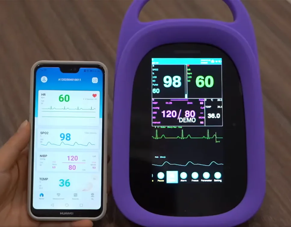 Portable 5.5" Touchscreen Veterinary Patient Monitor CE Declared Multi-Parameter Device for Blood Pressure EtCO2 SpO2