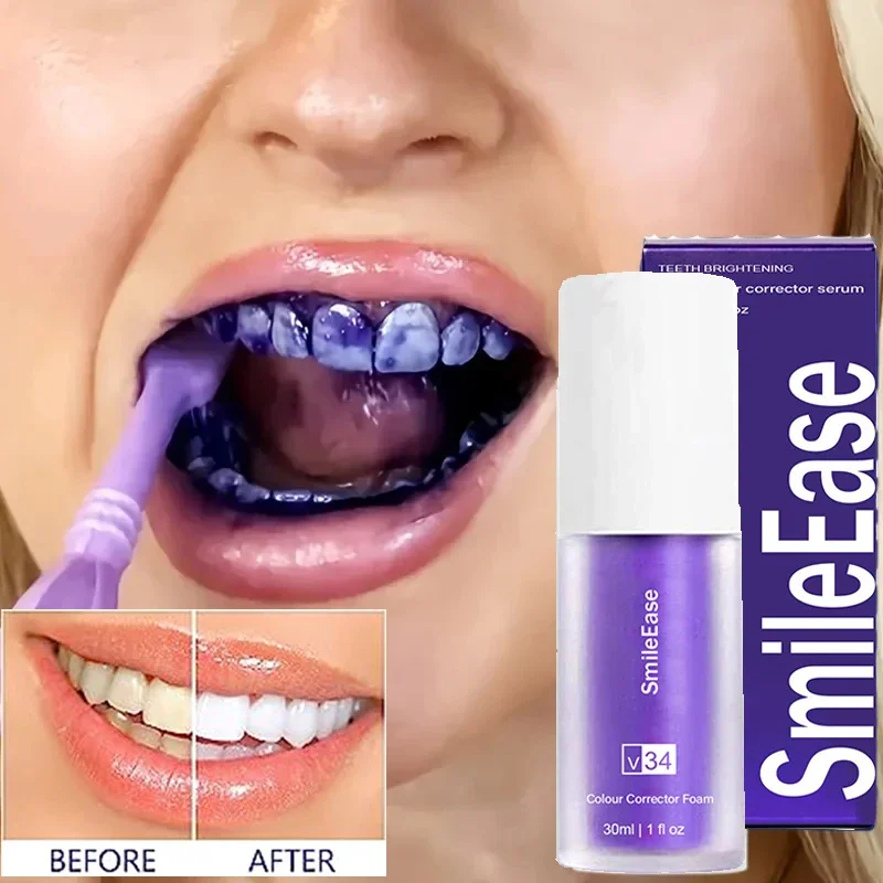 V34 30ml Smile ease Zahnpasta lila Farbe Korrektor Zahnpasta für Zähne weiße Aufhellung reduzieren Vergilbung Zahnpflege 2024 neu