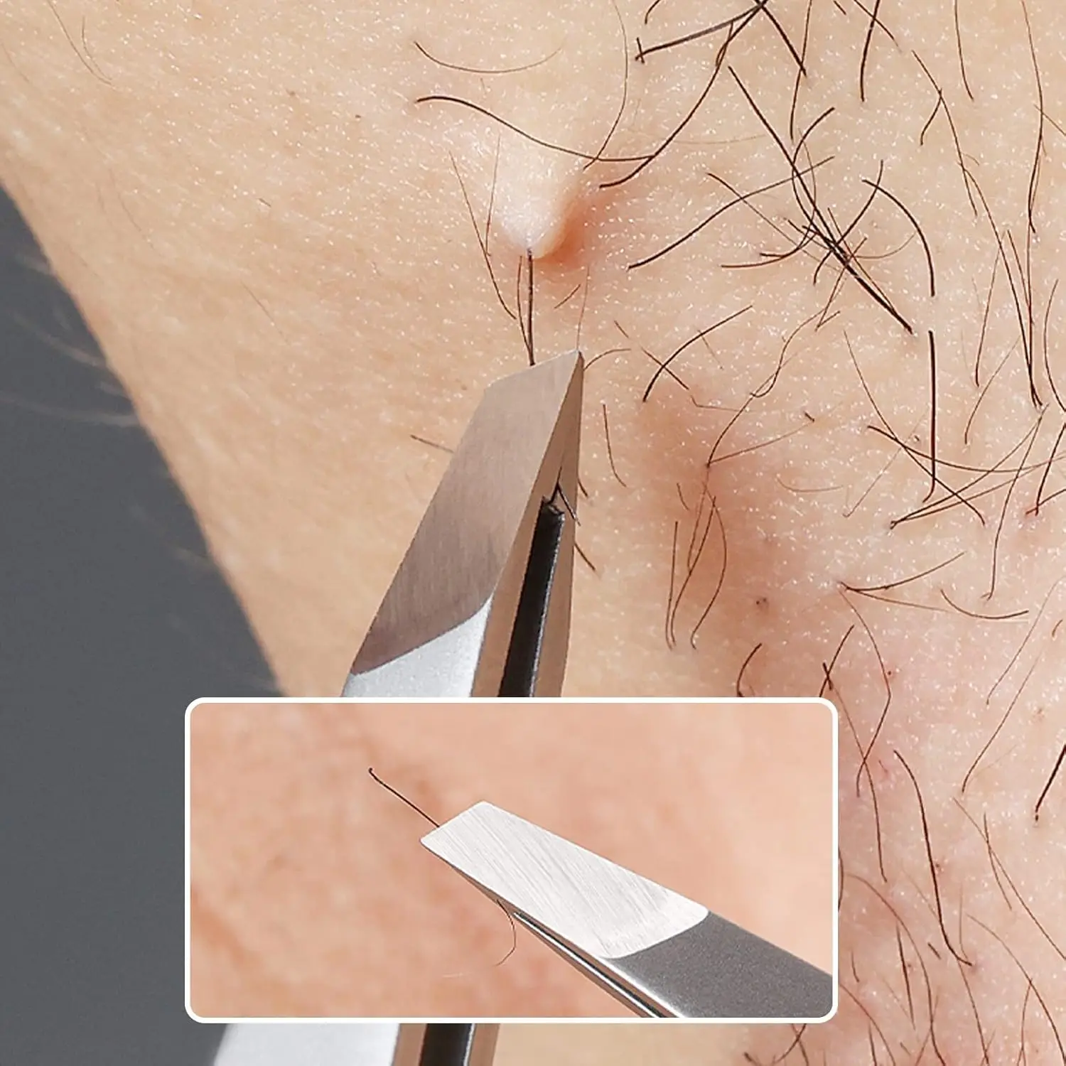1/4PCS แหนบคิ้วสแตนเลส - แหนบกำจัดขนมืออาชีพ - เหมาะสำหรับขนบนใบหน้าและขนคุด