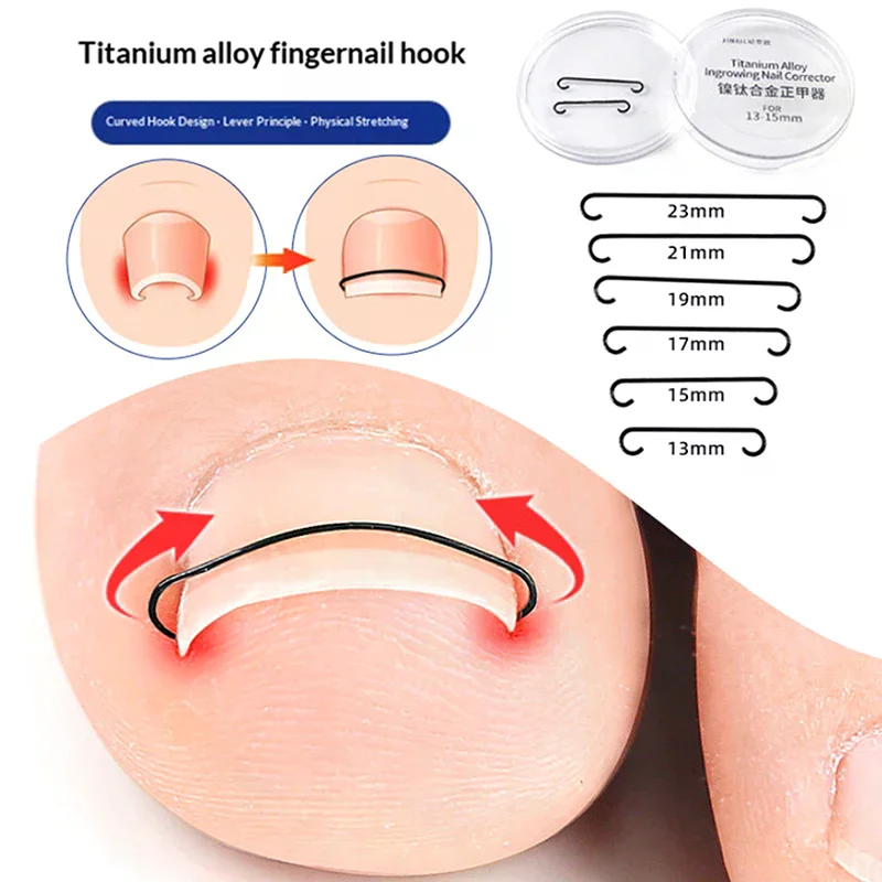 2Pcs Ingrown Toenai…