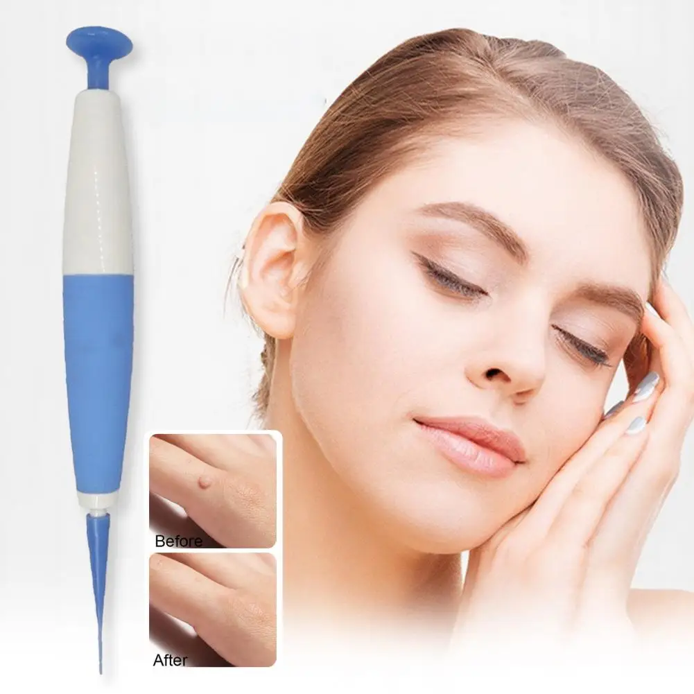 مجموعة أقلام متطورة لإزالة العلامات الجلدية للرجال والنساء ، سهلة الاستخدام ، مجموعة مزيل الثآليل ، آمنة ، فعالة ، صغيرة لسرعة