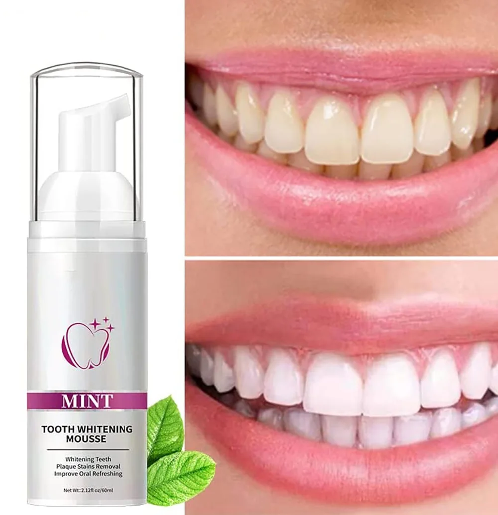 

Teeth Cleansing Whitening Mousse Removes Stains Fresh Breath Protects The Gums Improve Oral Hygiene Mousse Toothpaste Whitening