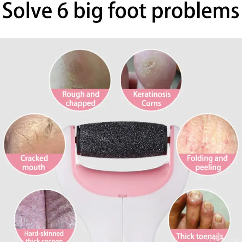 Youpin Pedicure เท้าไฟฟ้า Sharpeners ส้น Pedicure แฟ้มเท้า Exfoliating ผิวหนังที่ตายแล้ว Remover Professional แฟ้มเท้าเครื่องมือดูแล