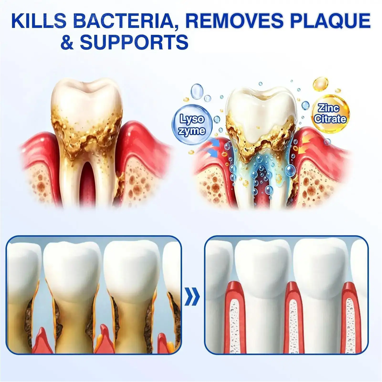 3pcs Gum & Enamel Care Gel, Teeth Nourishing O ral Care For Travel Commuting Business Trip Shower Vacation, Daily Gum Care