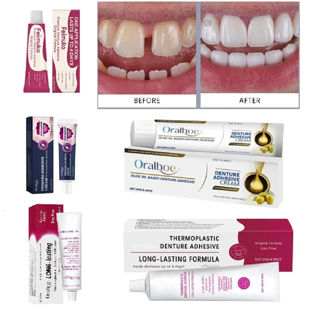 Thermoplastic Denture Adhesive Long-lasting Denture Fixing Adhesive Improve Comfort Denture Care Products Odontologia