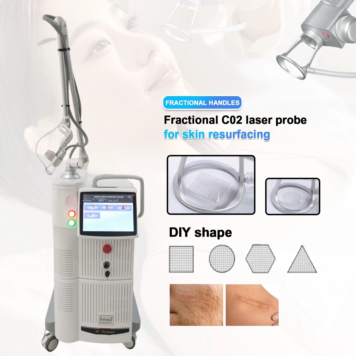

Co2 Fractional Skin Co2 Gesicht Treatment Machine 10600nm Newest Lase Beaut Machine For Resuacing Acne Scars