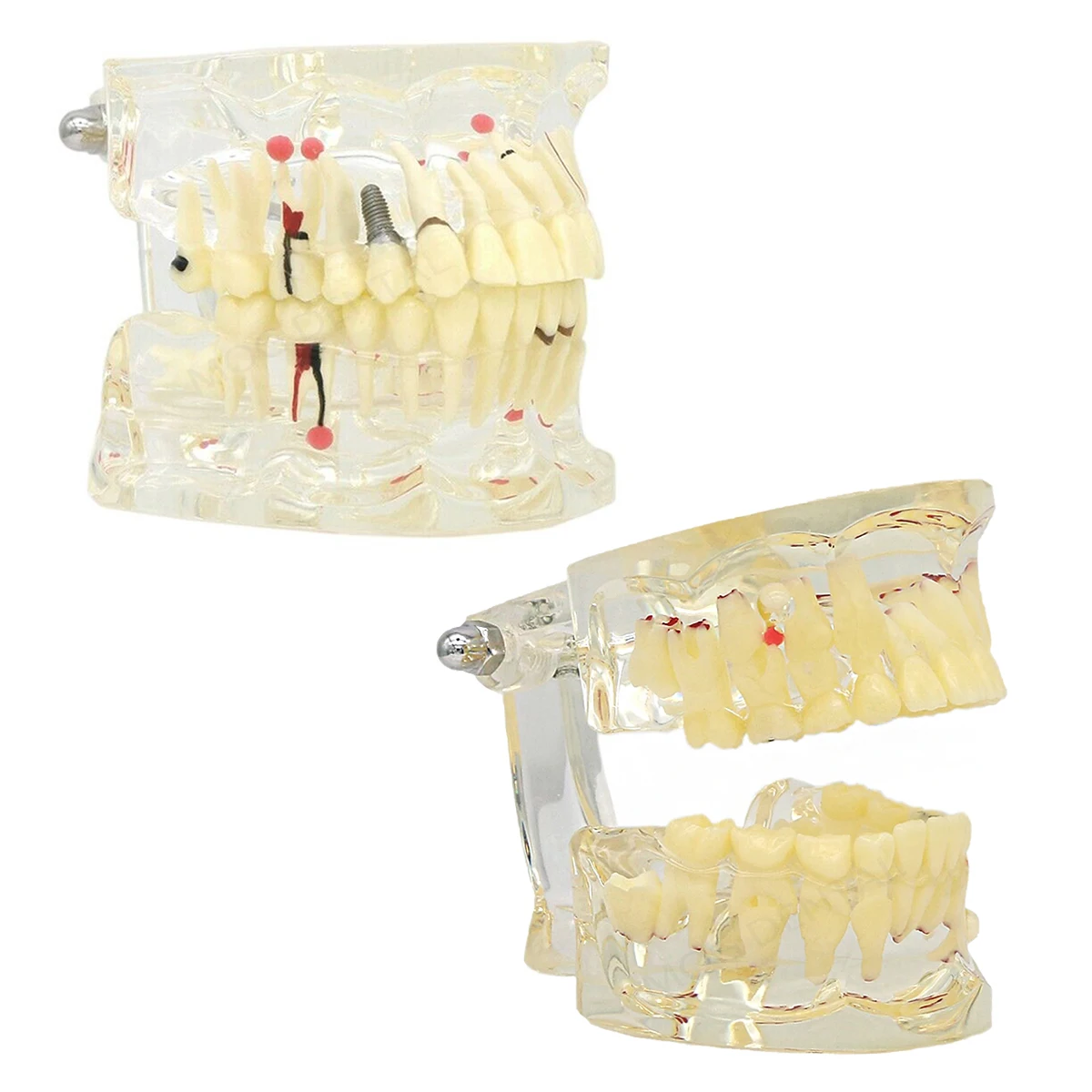 Dental Pathological Teeth Model with Adult and Children Tooth Dismountable Models Dentistry Model For Student Study Teach Demo