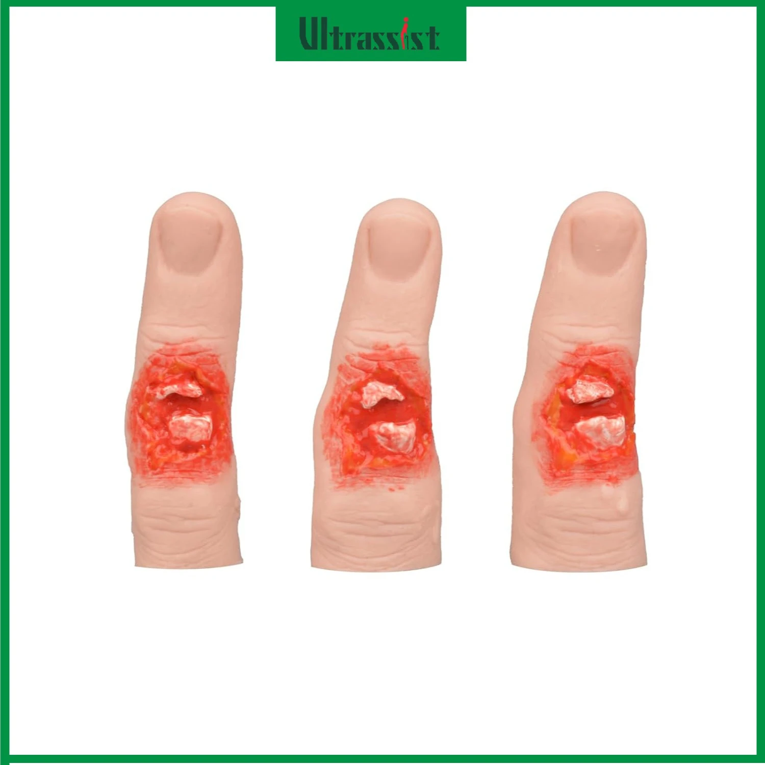 Ultrassist Finger Fracture Wound Glove Model Finger Injury Simulation Trainer Wound Pack for First Aid Workplace Safety Training