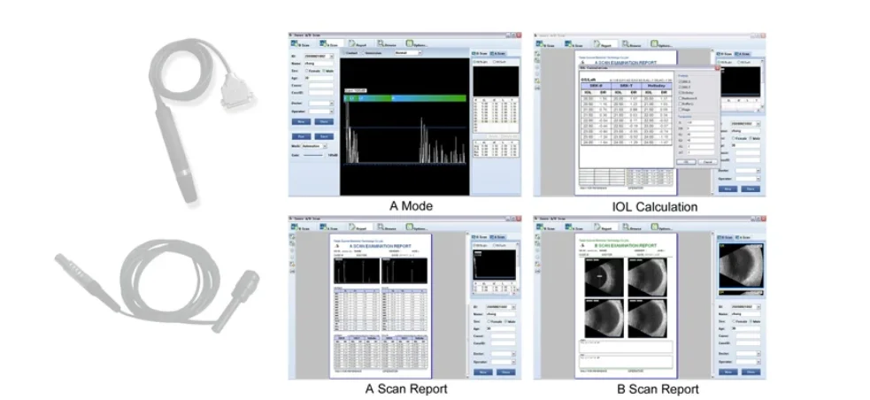 SW-2100  USB interfaced ophthalmic Av/B scan with best quality and precise data Ophthalmic A/B Scan Portable A/B scan