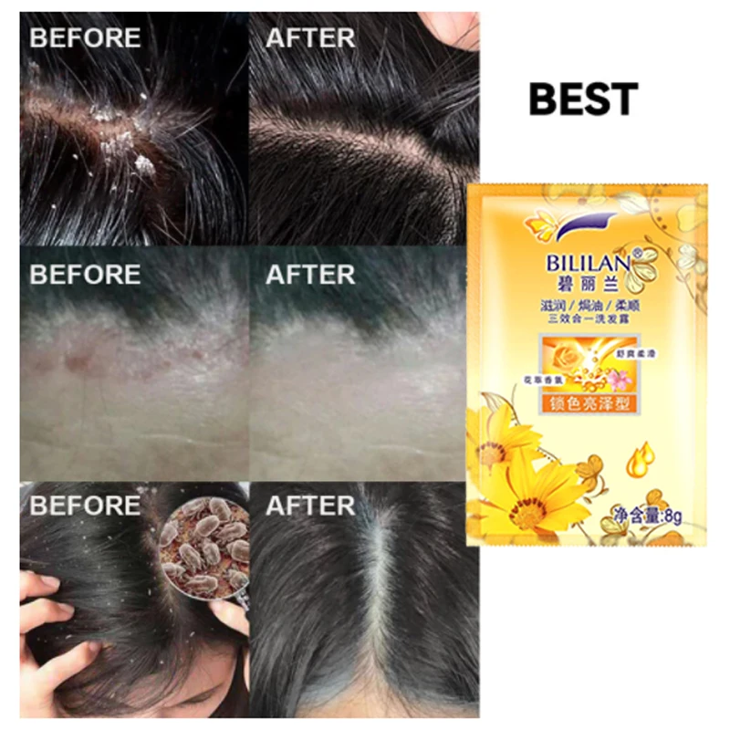 Fashion Disposable Flower Xourshing Essence Shampoo hair Loss Treatment Hair Care Nourish Repair Hair 8g per package 10pcs/lot