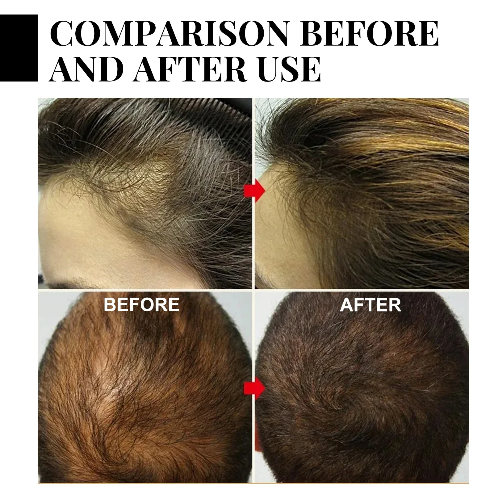 Fast Ginger Hair Growth Spray - Hair Care Hair Serum ulasan dan harga