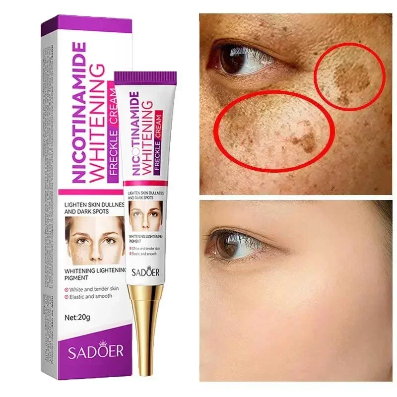 Niacinamide Whitening Freckle Cream Effectively Lightens Black Spots Acne Marks Removes Melasma Brightens Healthy Skin Mild