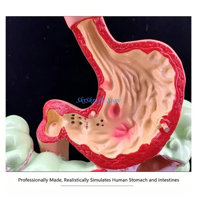 E65E Anatomy Demonstration Model for Pathology Study, 3D Sectional PVC Teaching Aid for Class Display and Learning Reference