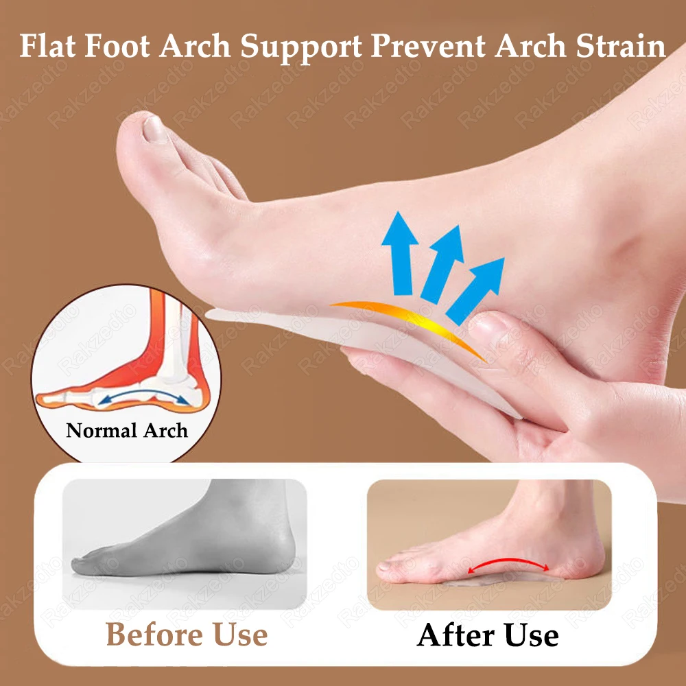 Silicone Arch Support Inserts for Sandals High Heels Woman Non-Slip Gel Insoles for Shoes Man X-Legs Flat Feet Corrector Insole