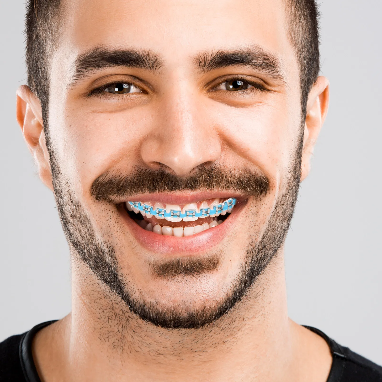 

2 шт. Стильные декоративные украшения для зубных брекетов, легко устанавливаются и снимаются, портативные, для лигатурных завязок и брекет-лент