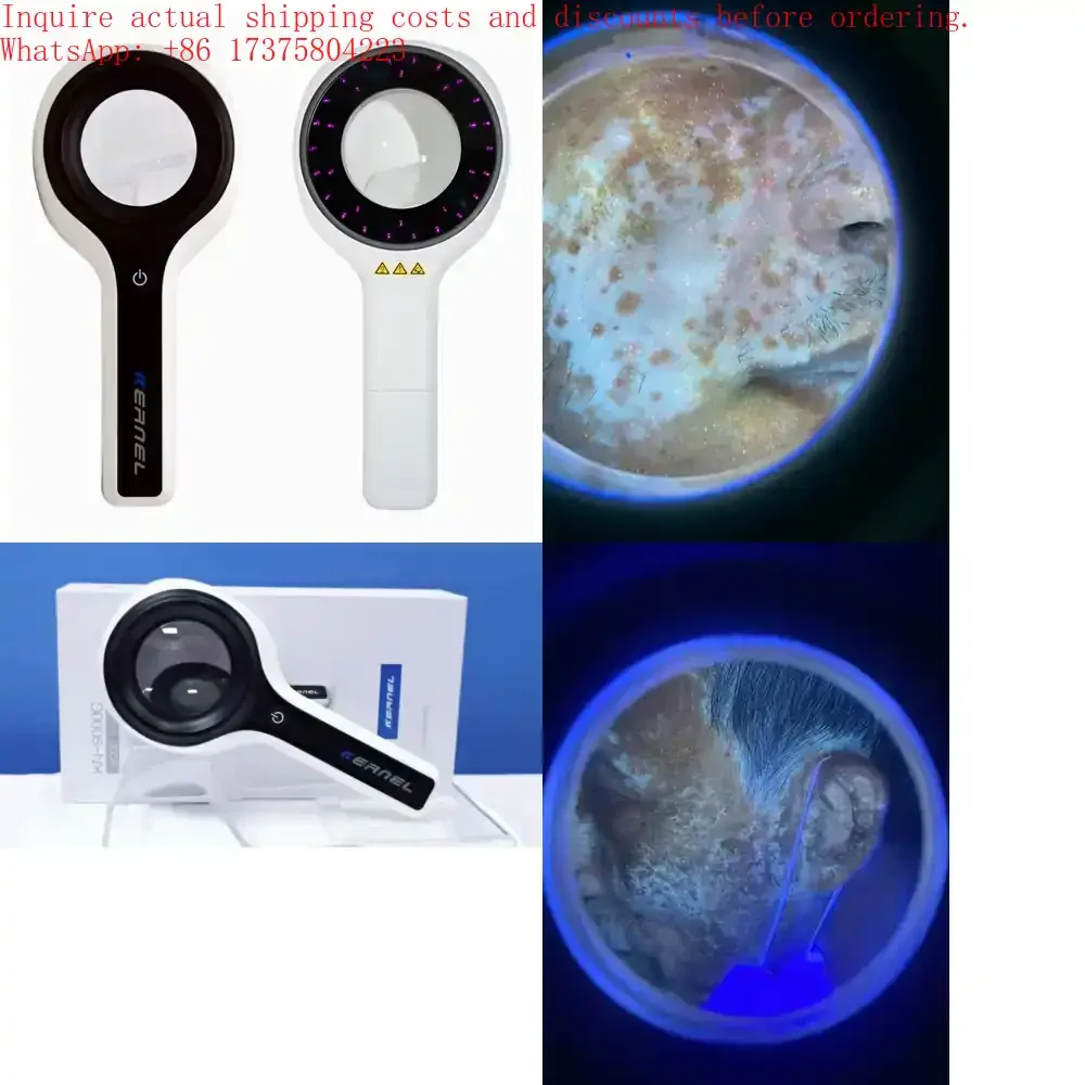 

Kernel KN-9000B Dermatoscopio Profesional Medical Woods Lamp for Vitiligo Diagnosis