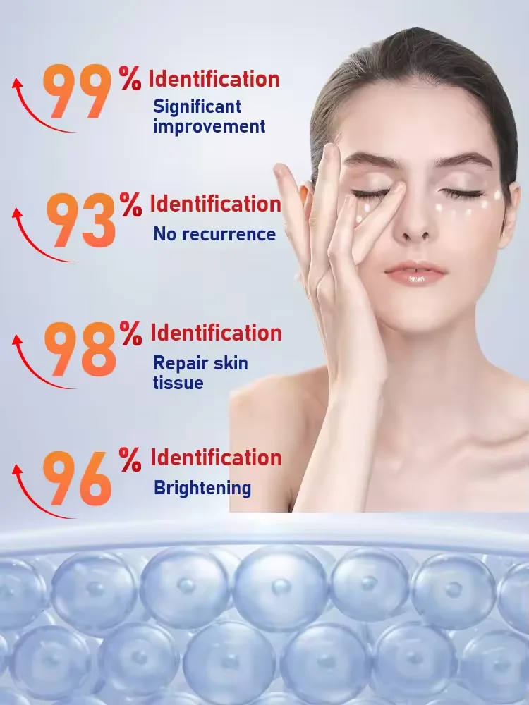 DIGA GOODBYE PARA SUAS FIELAS! GANHE RID OF EYE BAGE E CIRCLOS DARK EM JUST 7 DIAS.