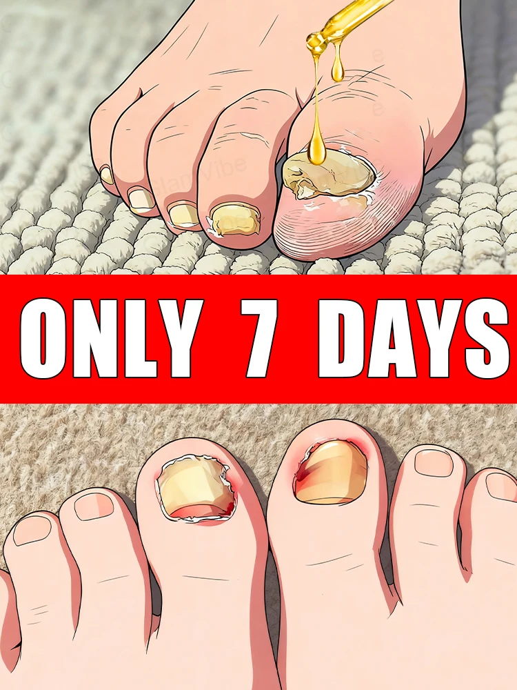 مانيكير لعلبة سيئة في 7 أيام وداع أدوات تنظيف إصلاح الأظافر والباديكير #1