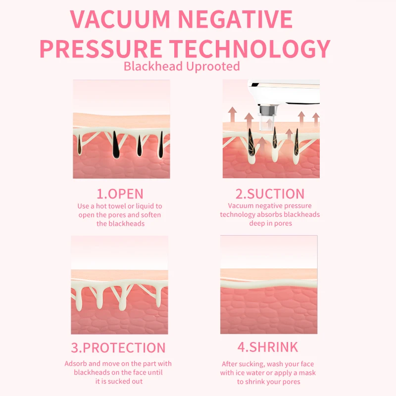 เครื่องทำความสะอาดรูขุมขนและฟื้นฟูผิวยอดนิยม เครื่องดูดสิวเสี้ยนดูดสิวเสี้ยนบนใบหน้า ดูแลจมูก ใช้ได้กับมือ