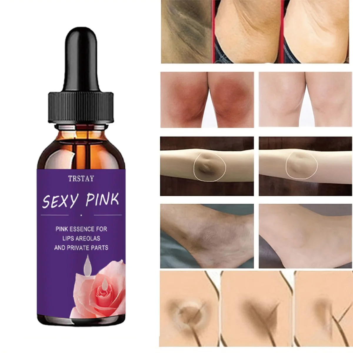 

TRSTAY Pink Essence Lip Glaze And Body Whitening Cream Repair Skin Color Difference Maternity Care Private Parts Body Cream