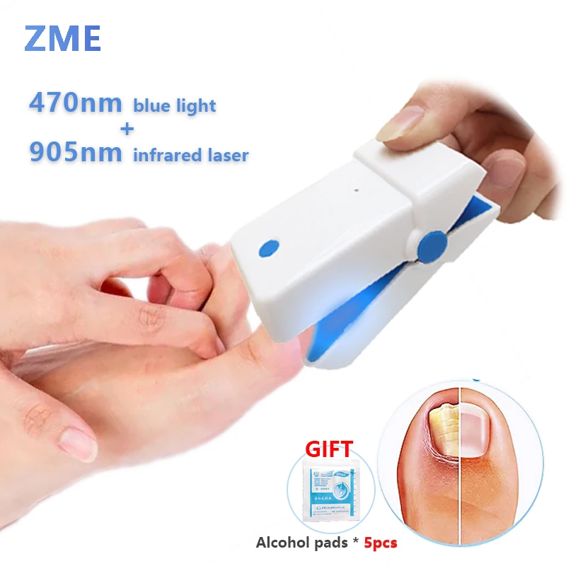 

ZME Nail Fungal Laser Device Nail Fungus Treatment Athlete's Foot Toenail Athlete's Foot Laser Therapy Fingernail Antifungal