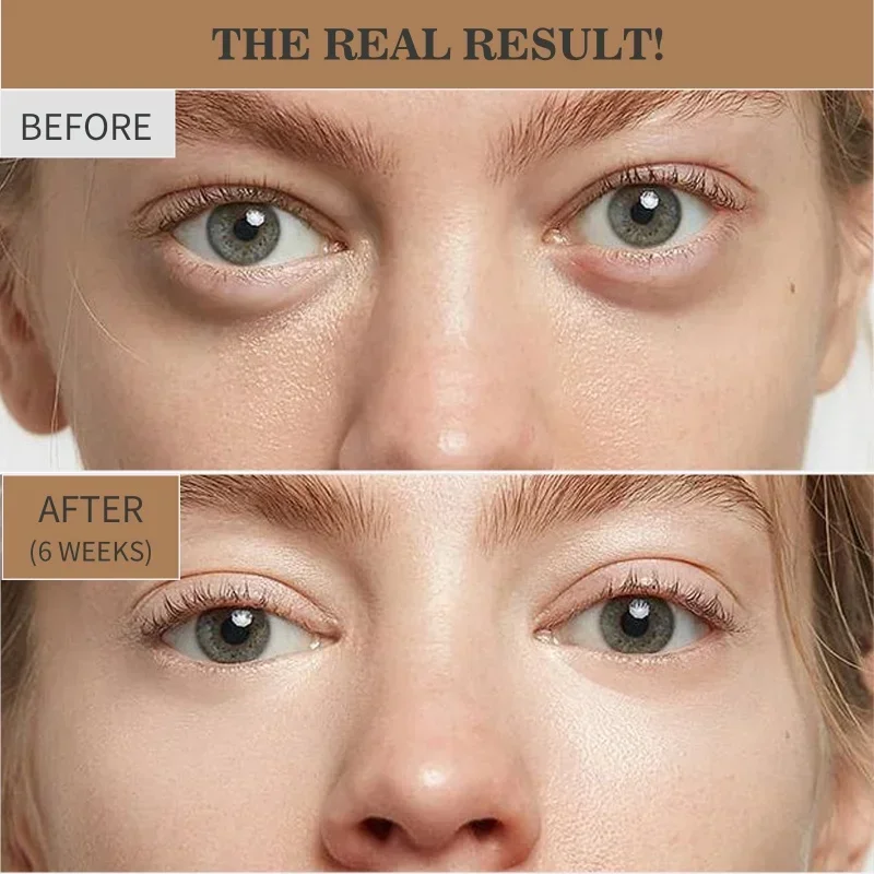 Retinol Eye Tightening Cream - Clinically tested formula with retinol & glycerol. Eliminates dark circles & wrinkles effectively