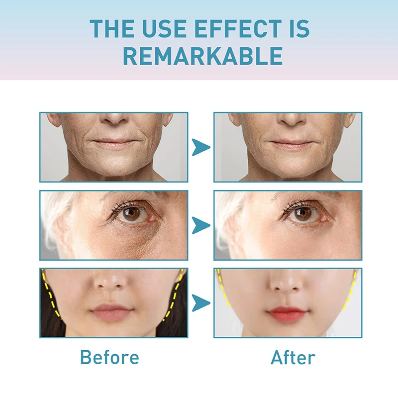 Facial Wrinkle Removal Cream Anti-aging Removing Wrinkles Around The Eyes Nose Lips Forehead Hydrating Moisturizing Facial Care