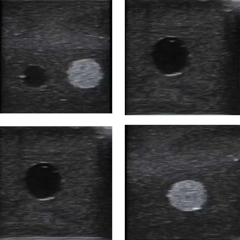 Ultrasound-guided puncture model tumor biopsy training teaching exercise module 125mm * 95mm * 45mm
