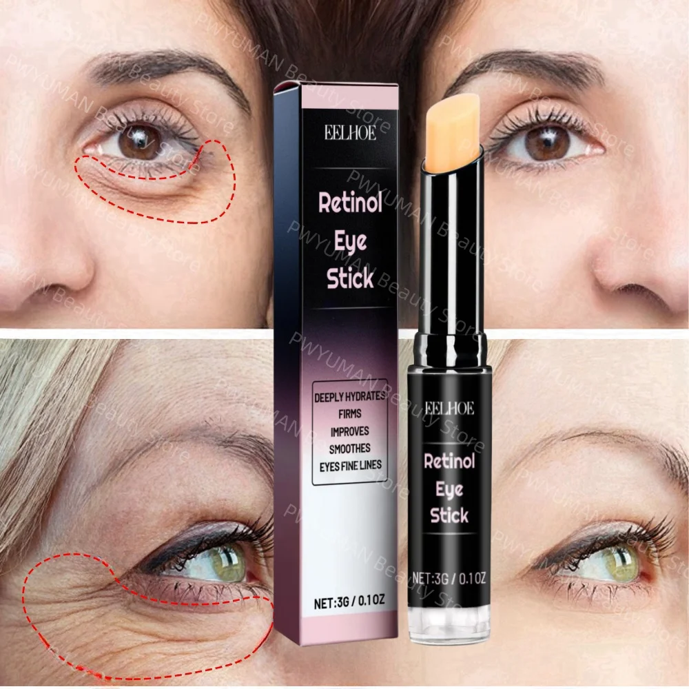 

Anti Puffiness Aging Dark Circles Eye Bags Retinol Eve Cream Stick Korean Skin Care Products