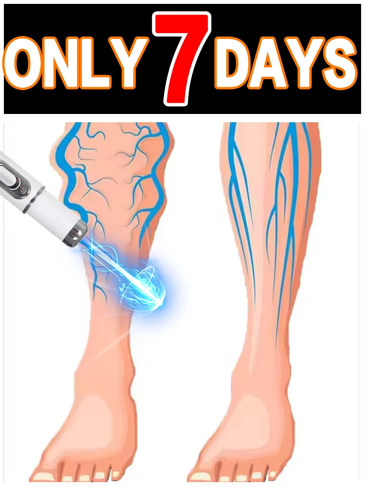 

Winter gift set with laser pointers to protect your legs.