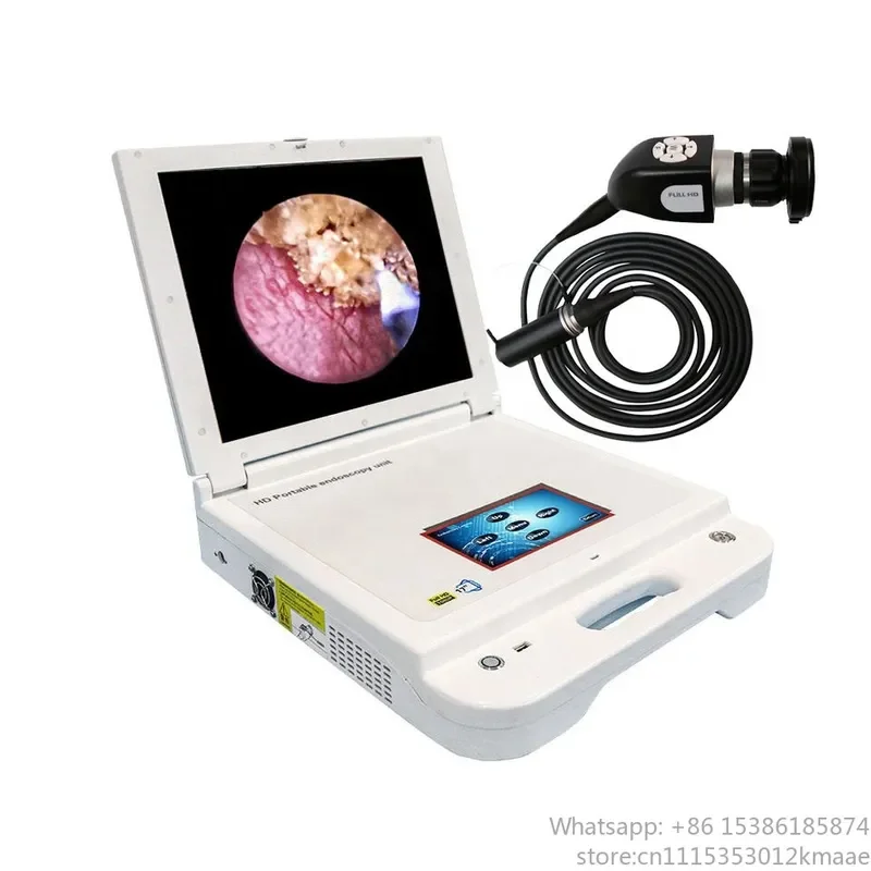 Vequyn Touchscreen Portable Veterinary ENT Endoscope Camera System for Vet Clinics — All-in-One Design