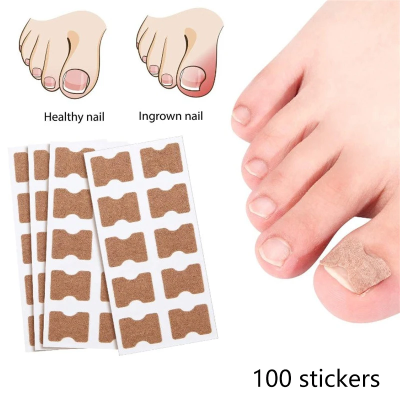 100Pcs Toenail Fungus Patch Sticky Nail Repair Patch Nail Ingrown Correction Sticker Toenail Care Paronychia Nail Patch