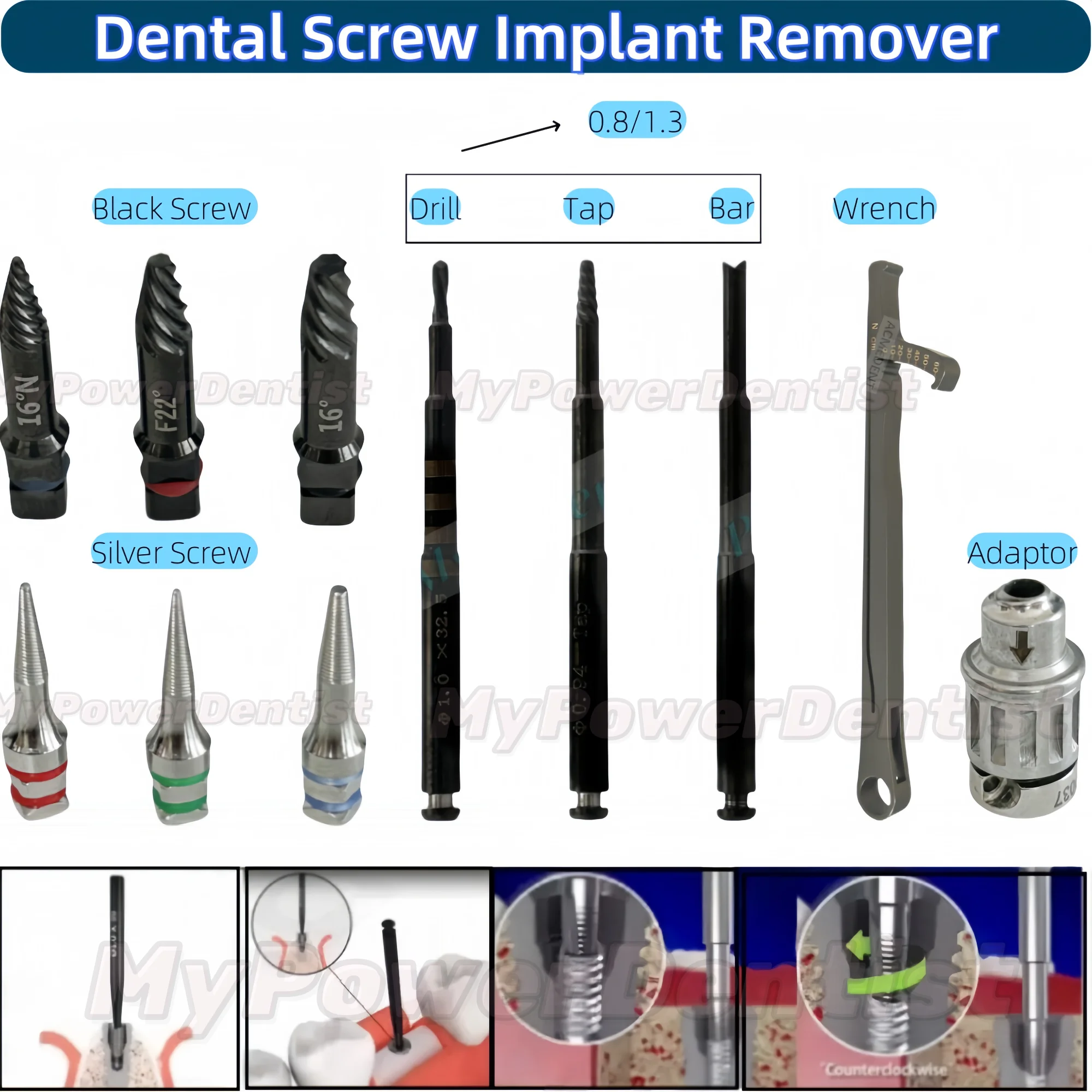 

Dental Screw Implant Remover Claw Reverse Tap Drill Driver Impalnt Broken Extractor 0.8/1.3