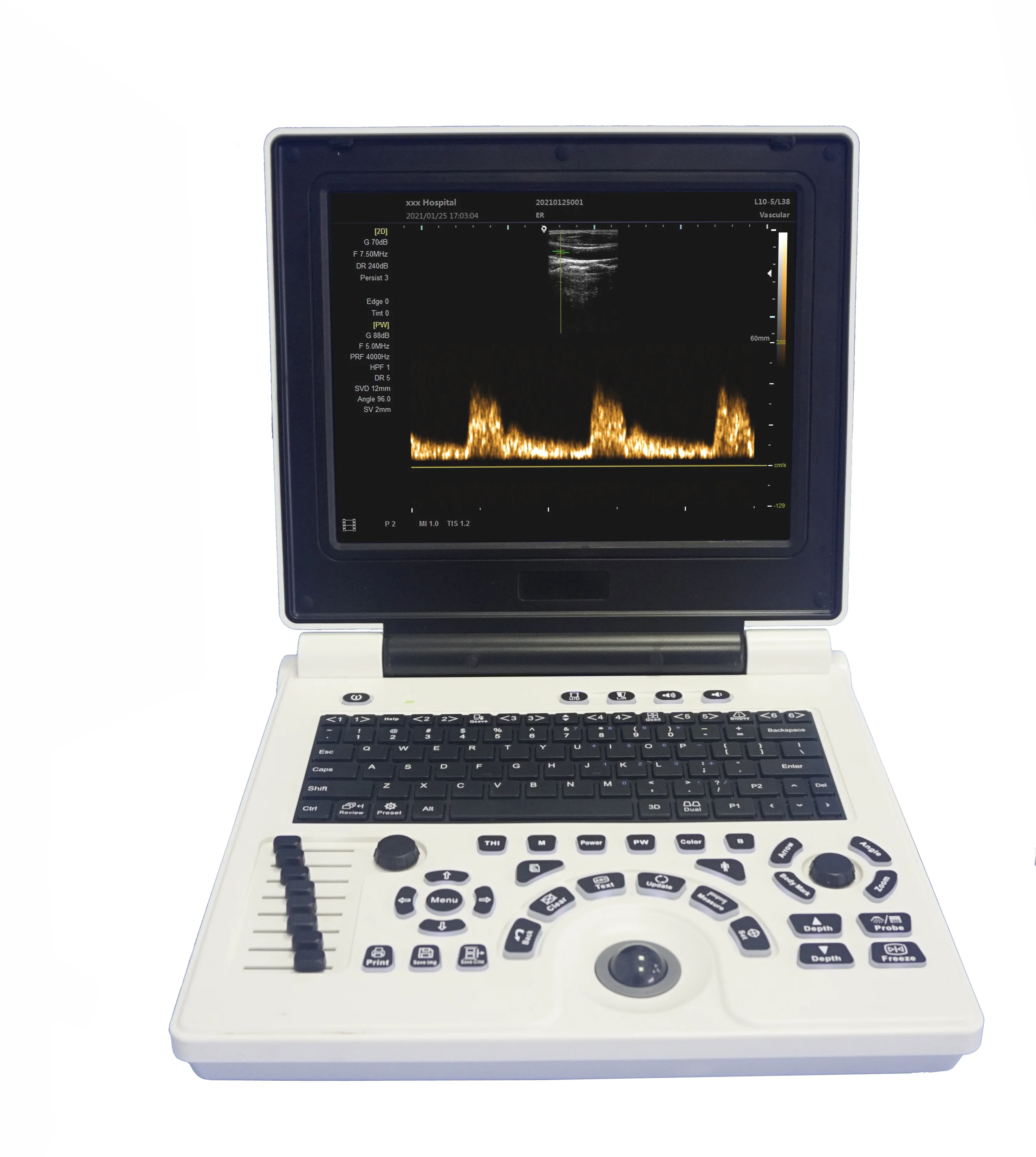 Henan YJ-P20 High-end B/W Diagnostic System Portable Ultrasound Scanner