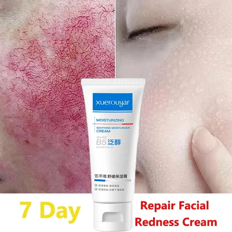 Facial Pirulás javító Tejszín Javít Érző Reve moisturizer Hidrát Igazság Oldat eltávolítása rosacea Háromláb Véredény Koreai Szépítő