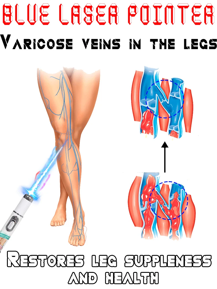 

Laser pen,Protect your health.