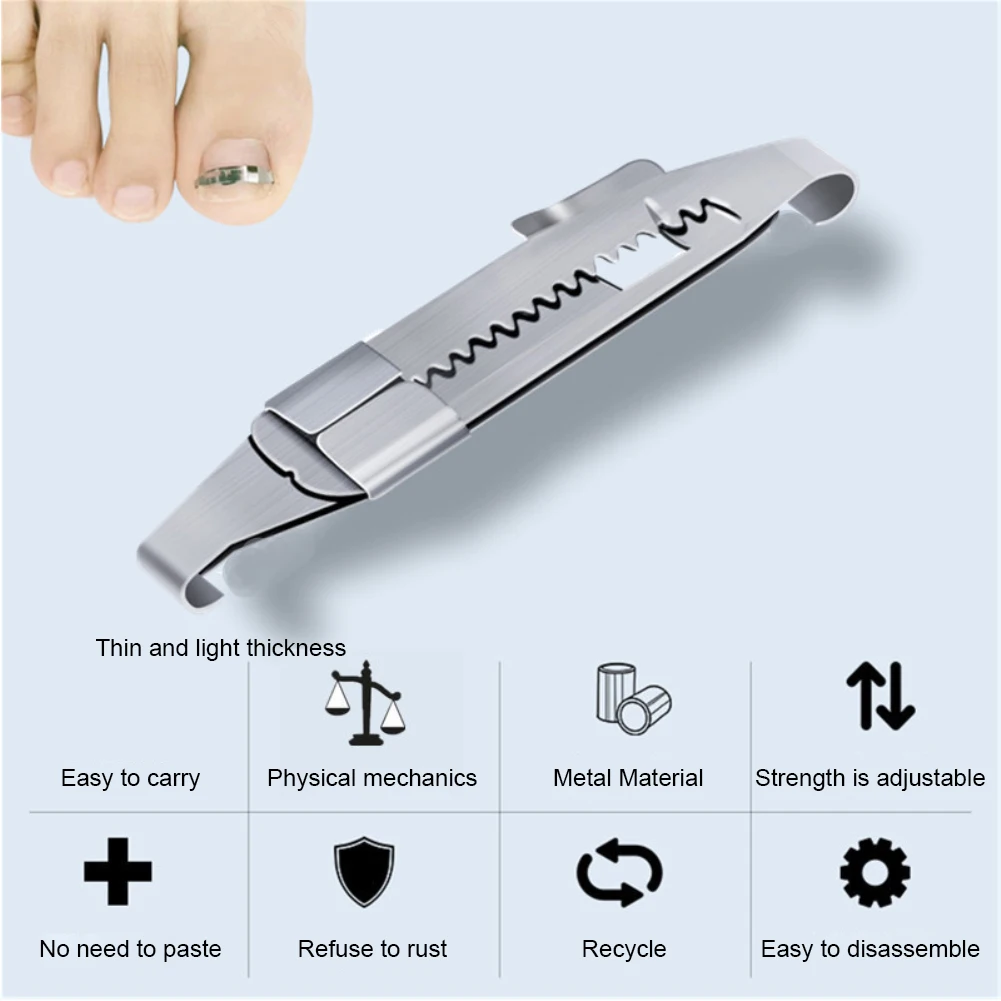 Pansement post opératoire ongle incarné Comment choisir le bon outil de correction