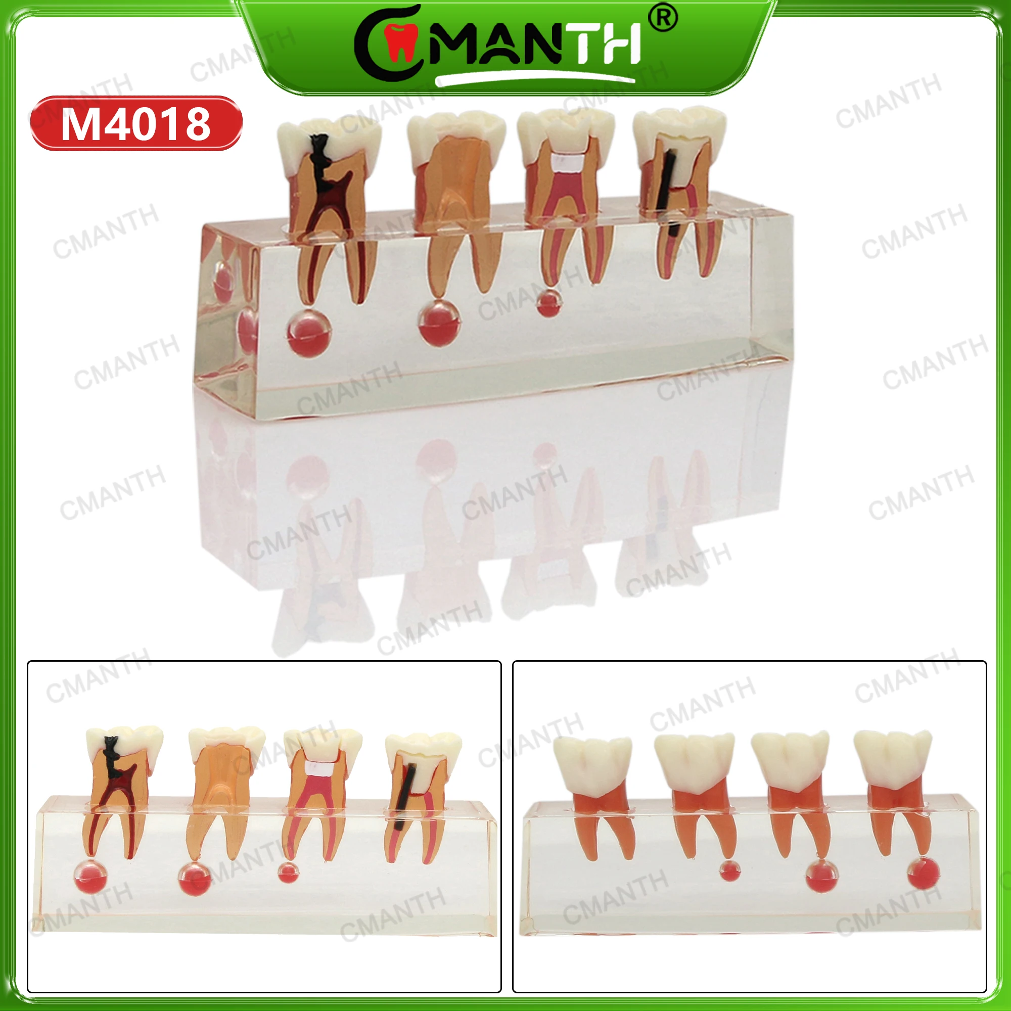 

Dentalmall Dental Teeth Model 4-Stage Endodontic Treatment Model M4018 For Studying Teaching