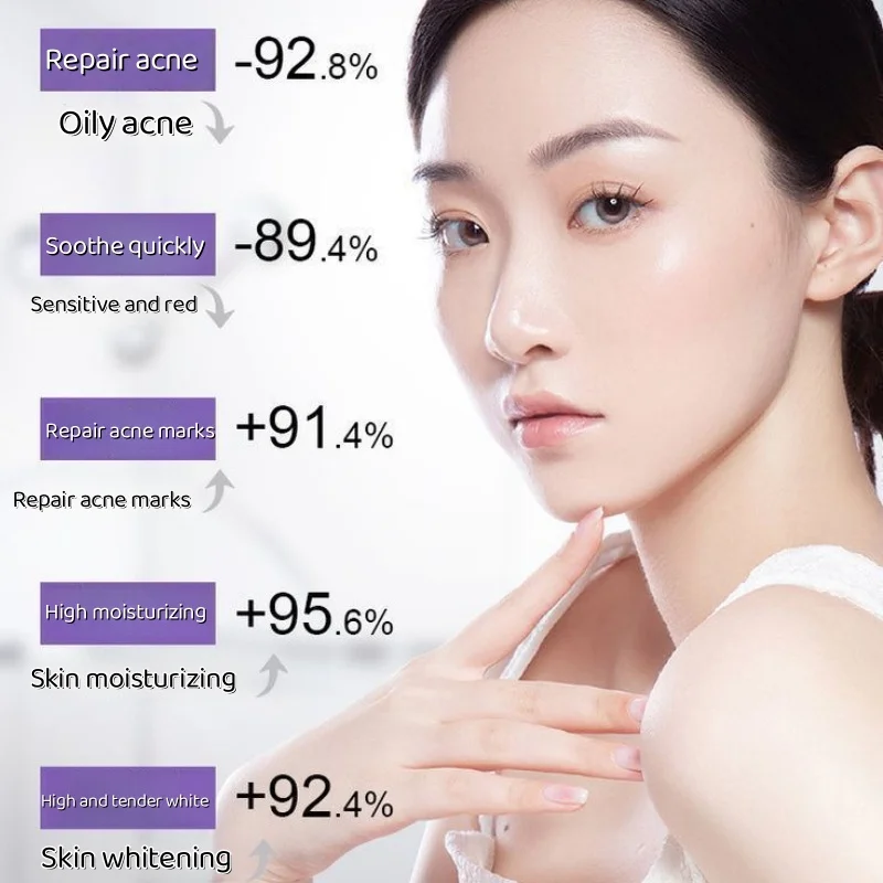 99% مستخلص طازج من محلول الألوة فيرا كريم جل مرطب وإصلاح يهدئ الوحمرار الجافة والحساسة جل الصبار البريلا 120 مل #4