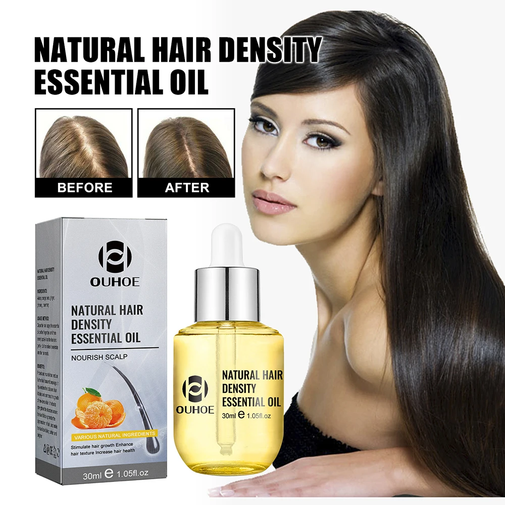 헤어 증모 에센셜 오일 30ml 헤어 케어 에센스 모발 - Hair Care Ginseng 리뷰 및 가격